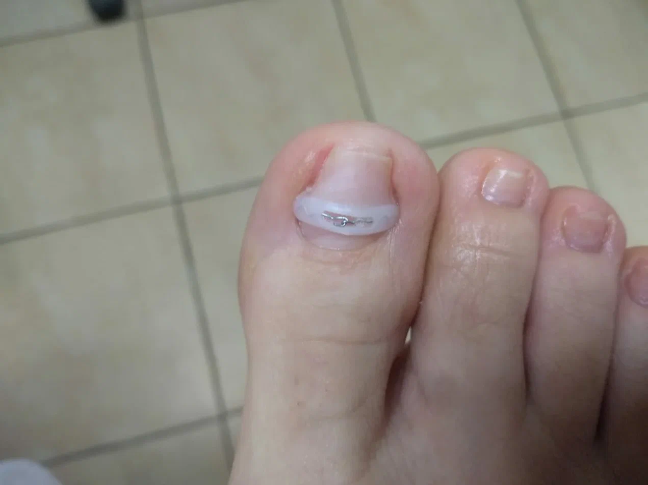 После лечения