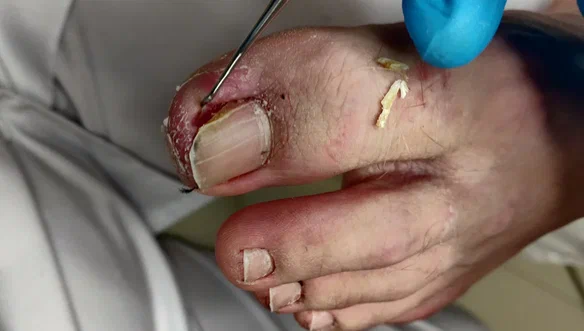 После лечения